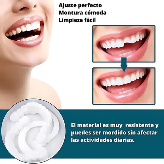 SmilePro 🦷 - Carillas Dentales Ajustables de Resina + ESTUCHE DE REGALO - ¡Últimas unidades!
